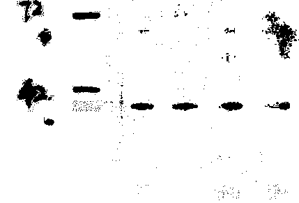 Preparation and purification method of antibody for inhibiting chronic rejection of transplanted organ