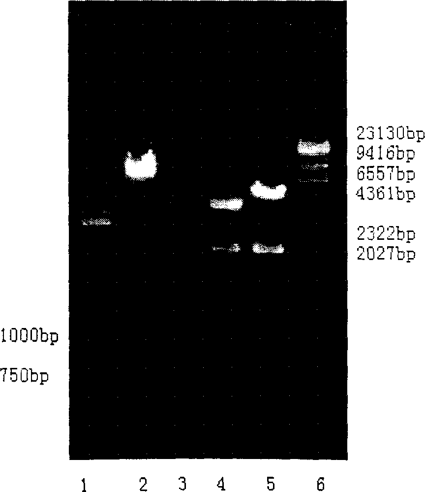 Fusion anticaries DNA vaccine and prepring method thereof