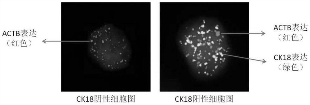 Kit for detecting gene expression of cytokeratin 18