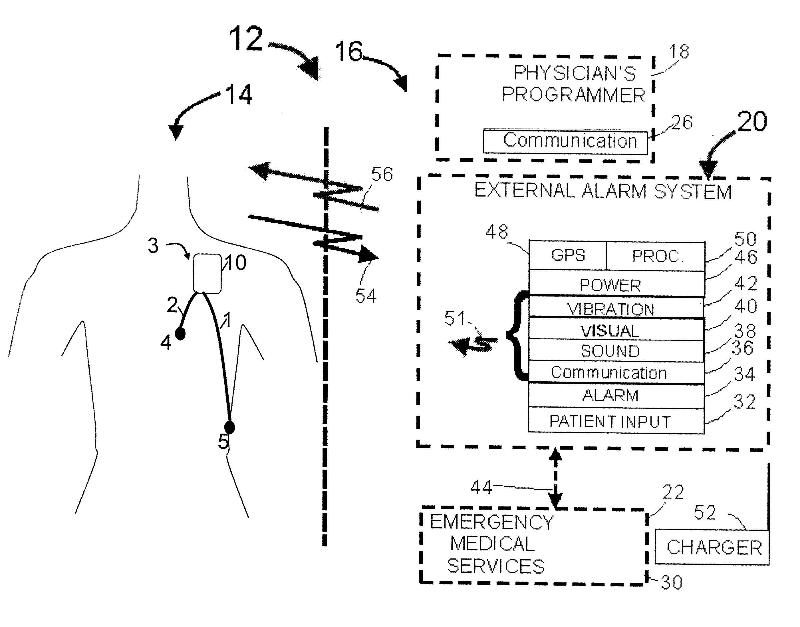 Parameter value rejection for a cardiac monitor