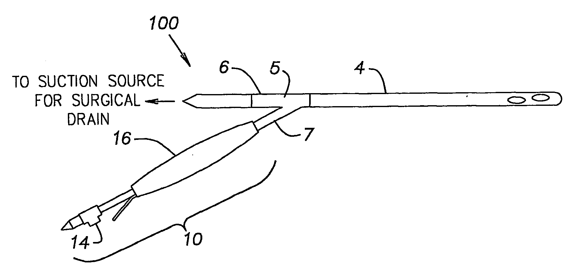 Catheter for removal of solids from surgical drains