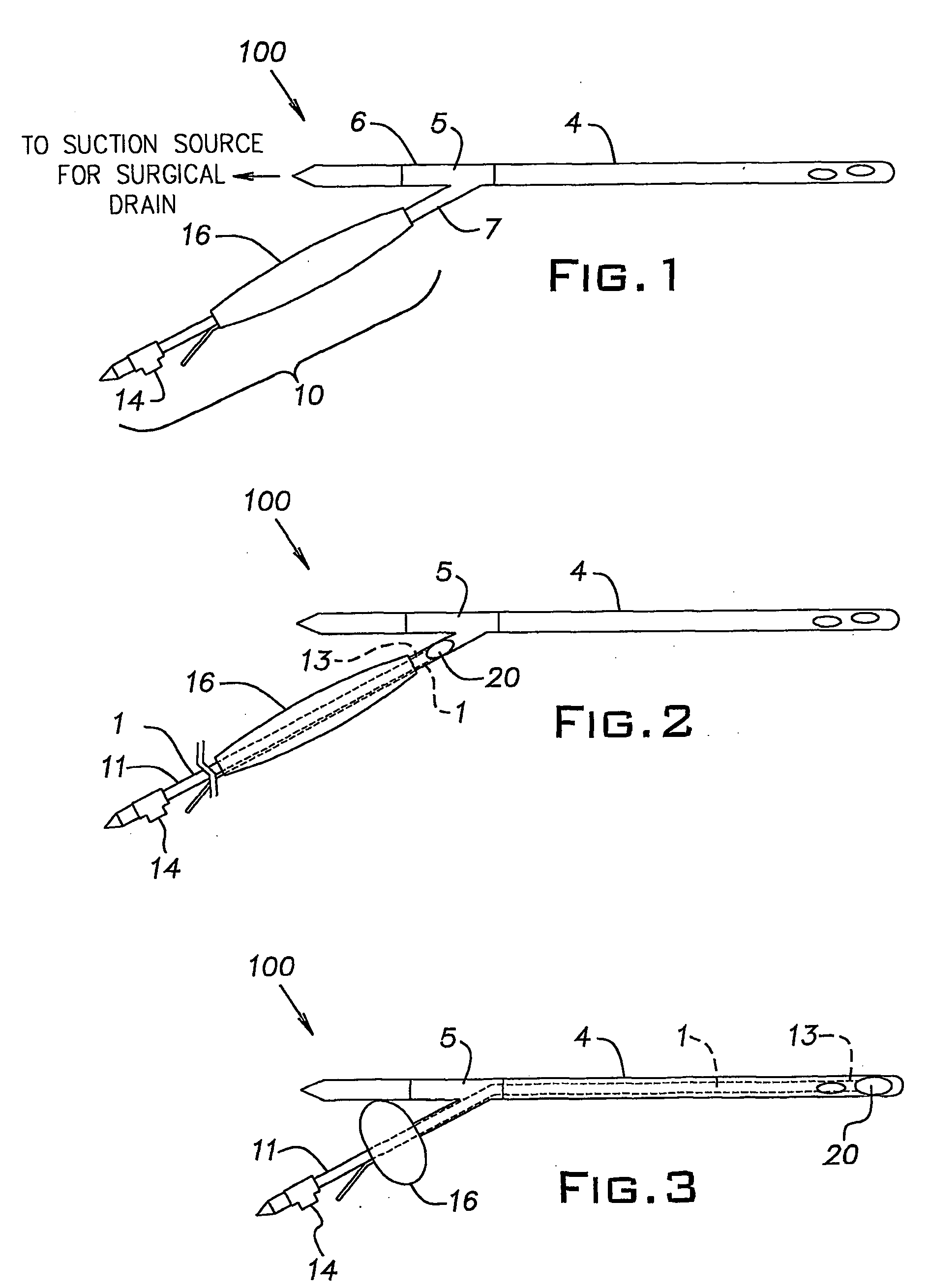 Catheter for removal of solids from surgical drains