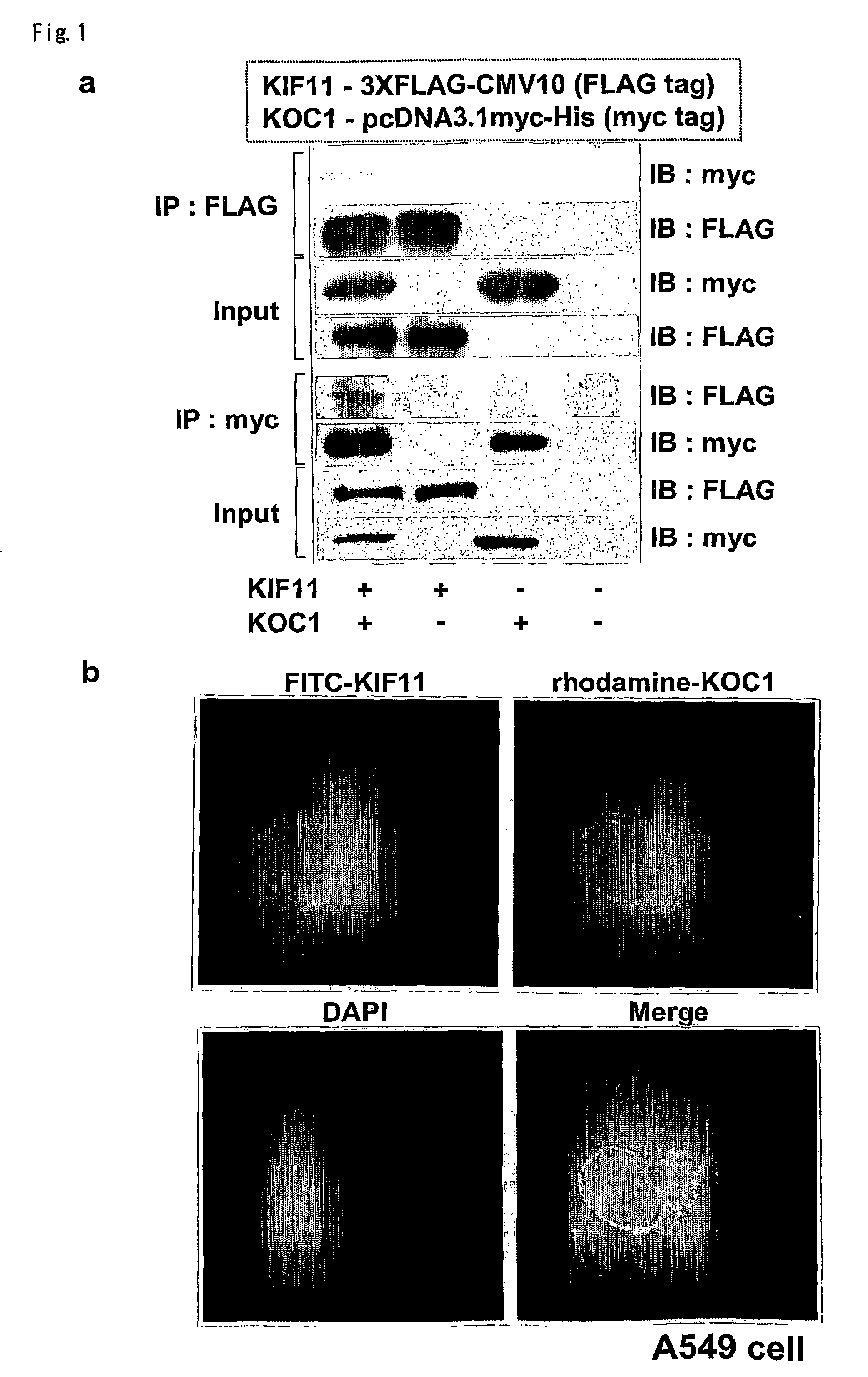 Method for diagnosing non-small lung cancer