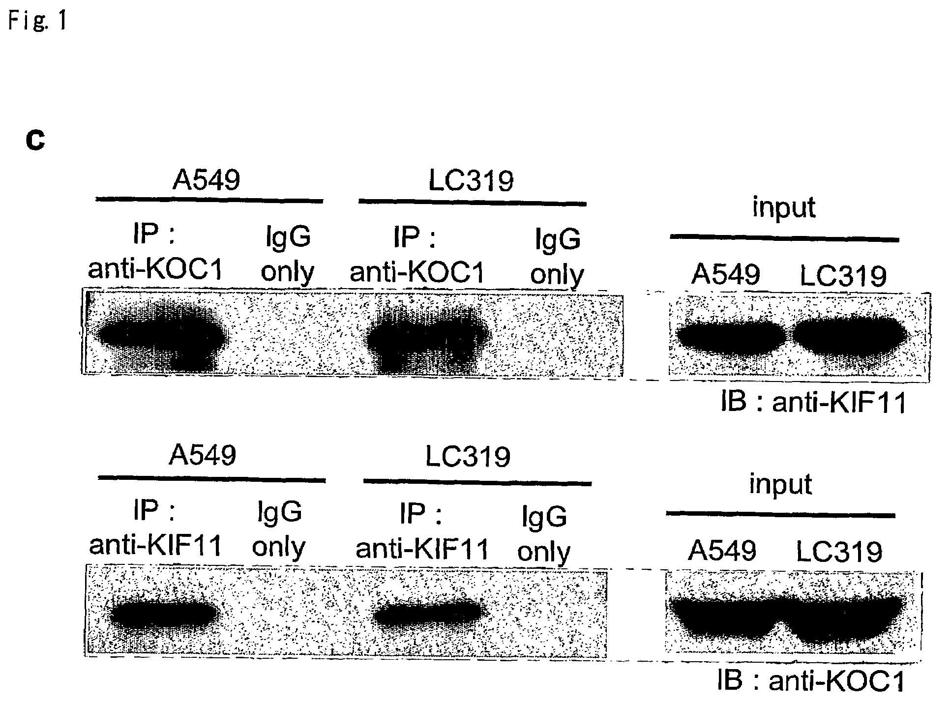 Method for diagnosing non-small lung cancer