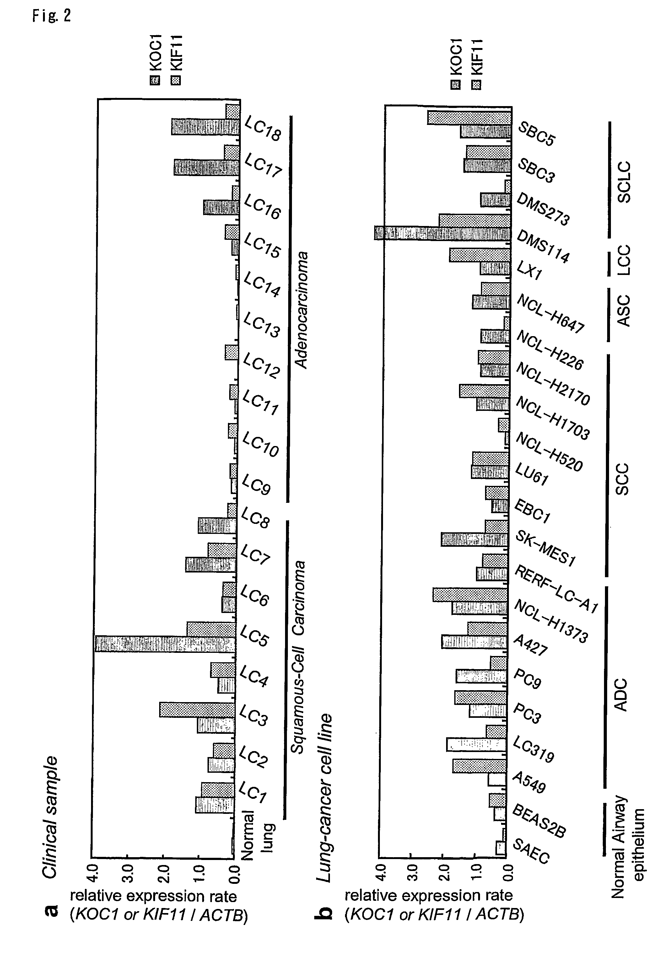 Method for diagnosing non-small lung cancer