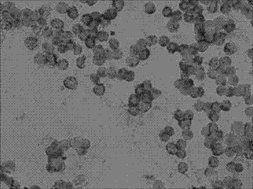 Kit and method for detecting horizontal in situ hybridization of MICRORNA-373 at the early pathological evolution stage of a variety of cancers and application thereof