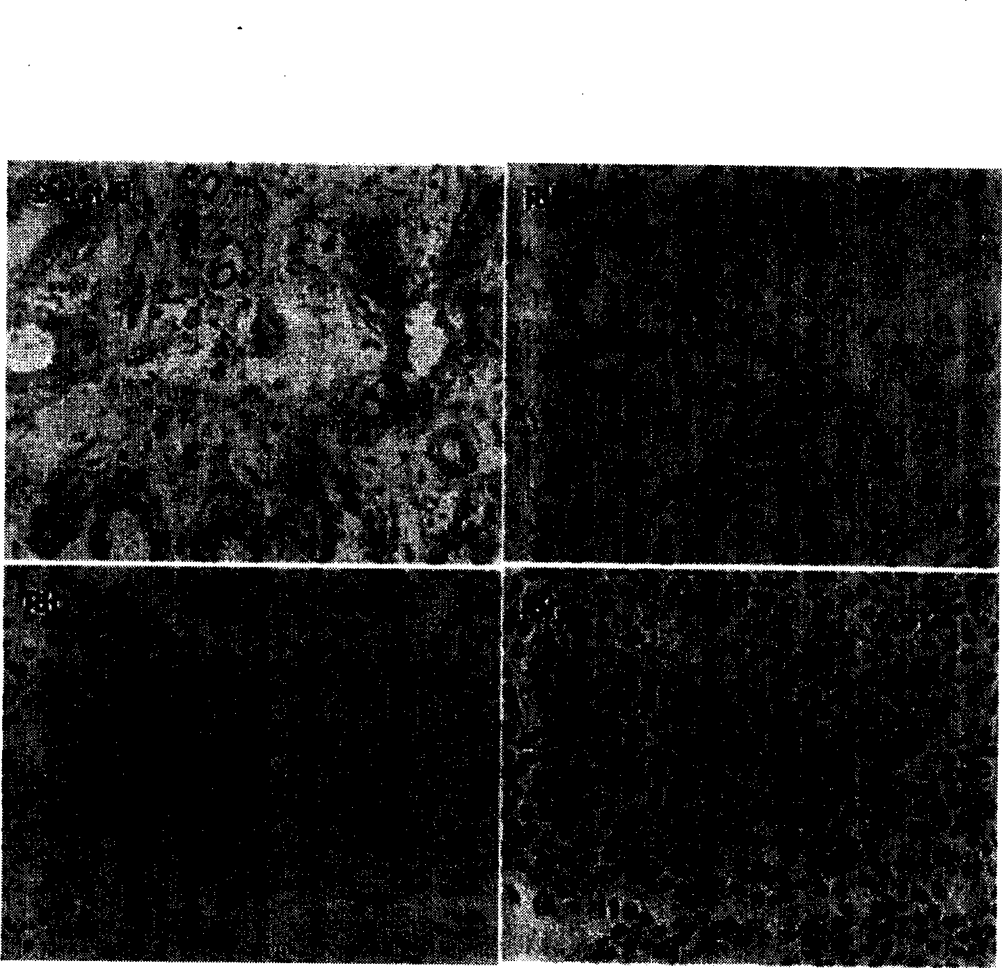 Nucleic acid adapter with high specificity and high affinity to human breast carcinoma tissue, preparation method and application thereof