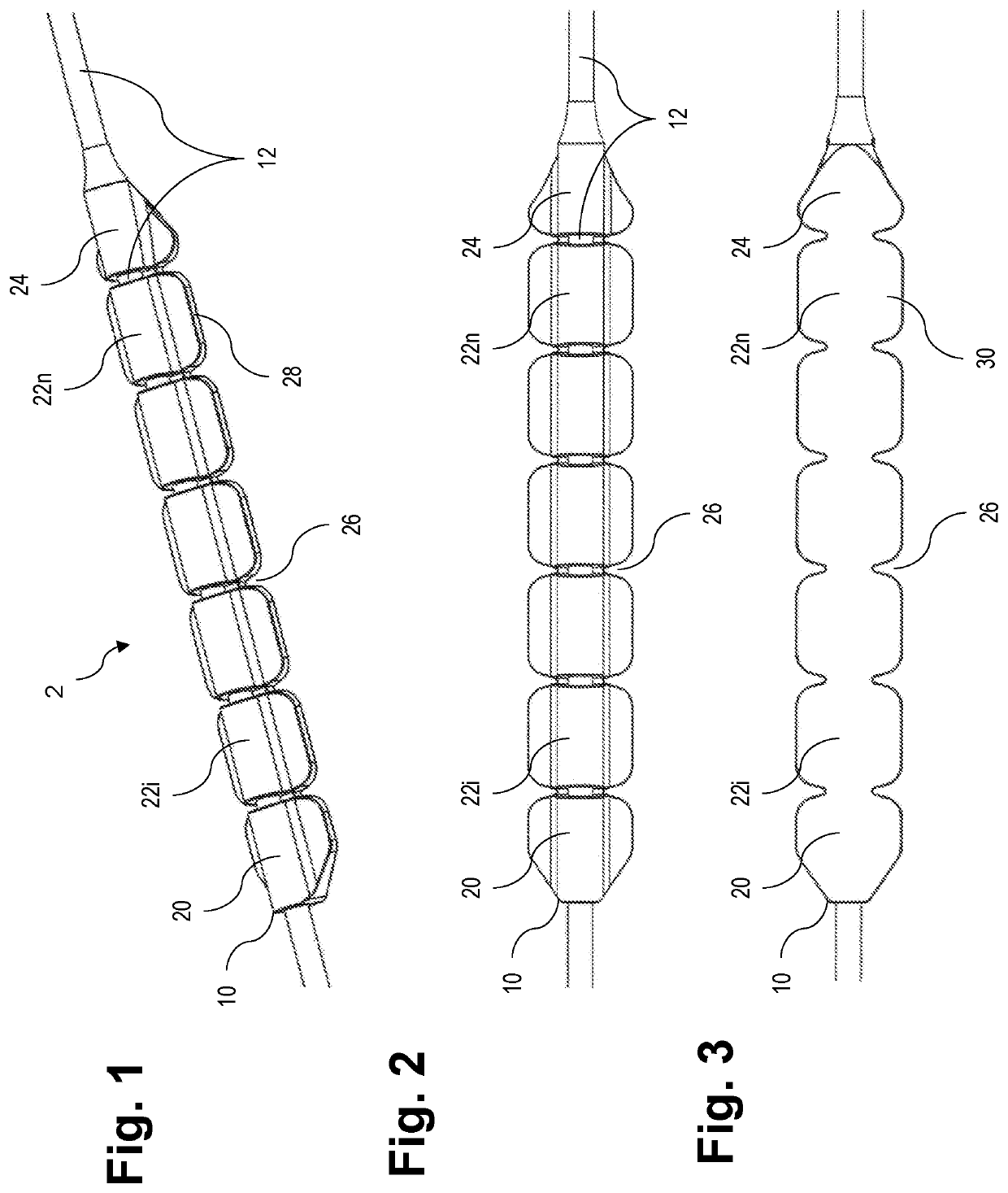 Load distributor for a sternum closure device and tool for cutting the load distributor