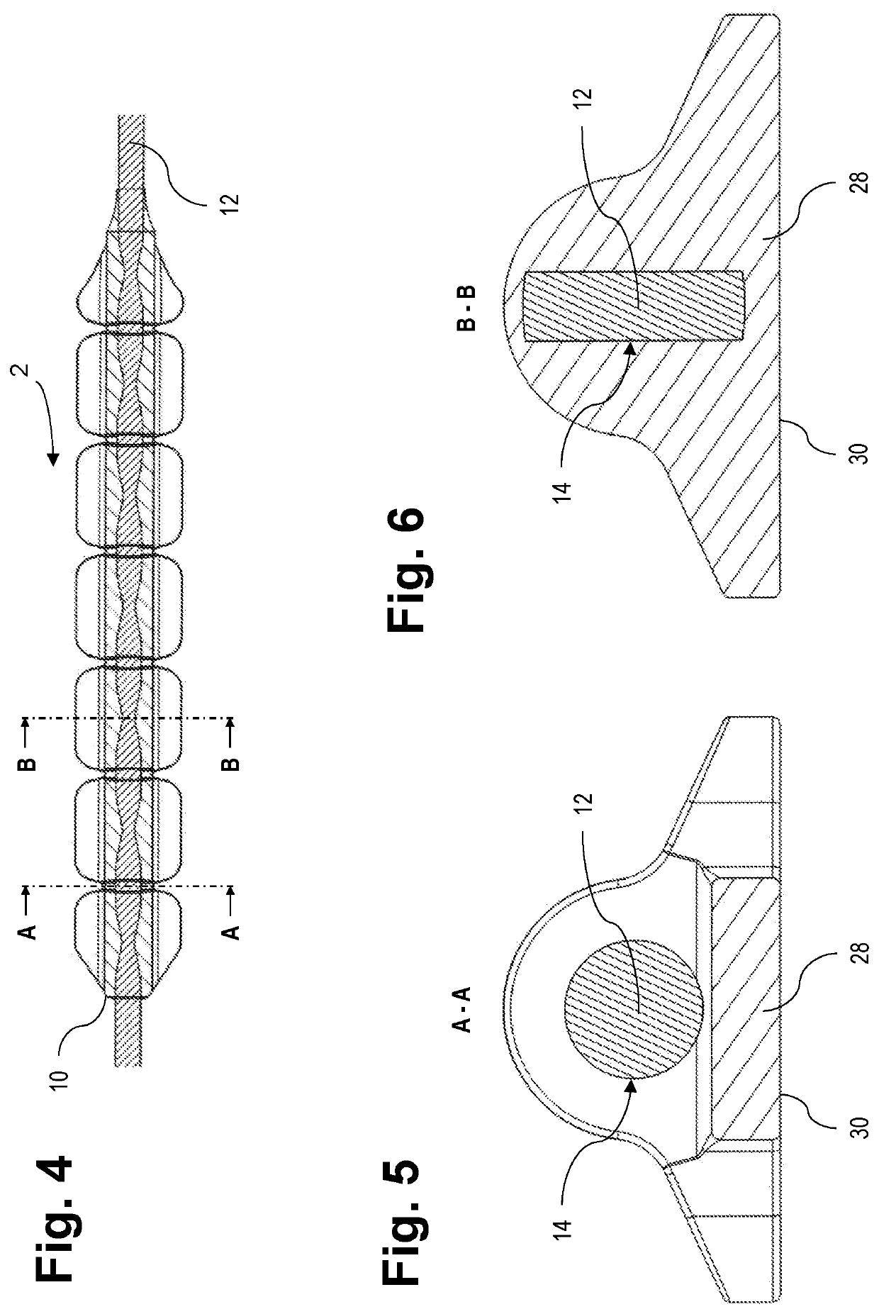 Load distributor for a sternum closure device and tool for cutting the load distributor