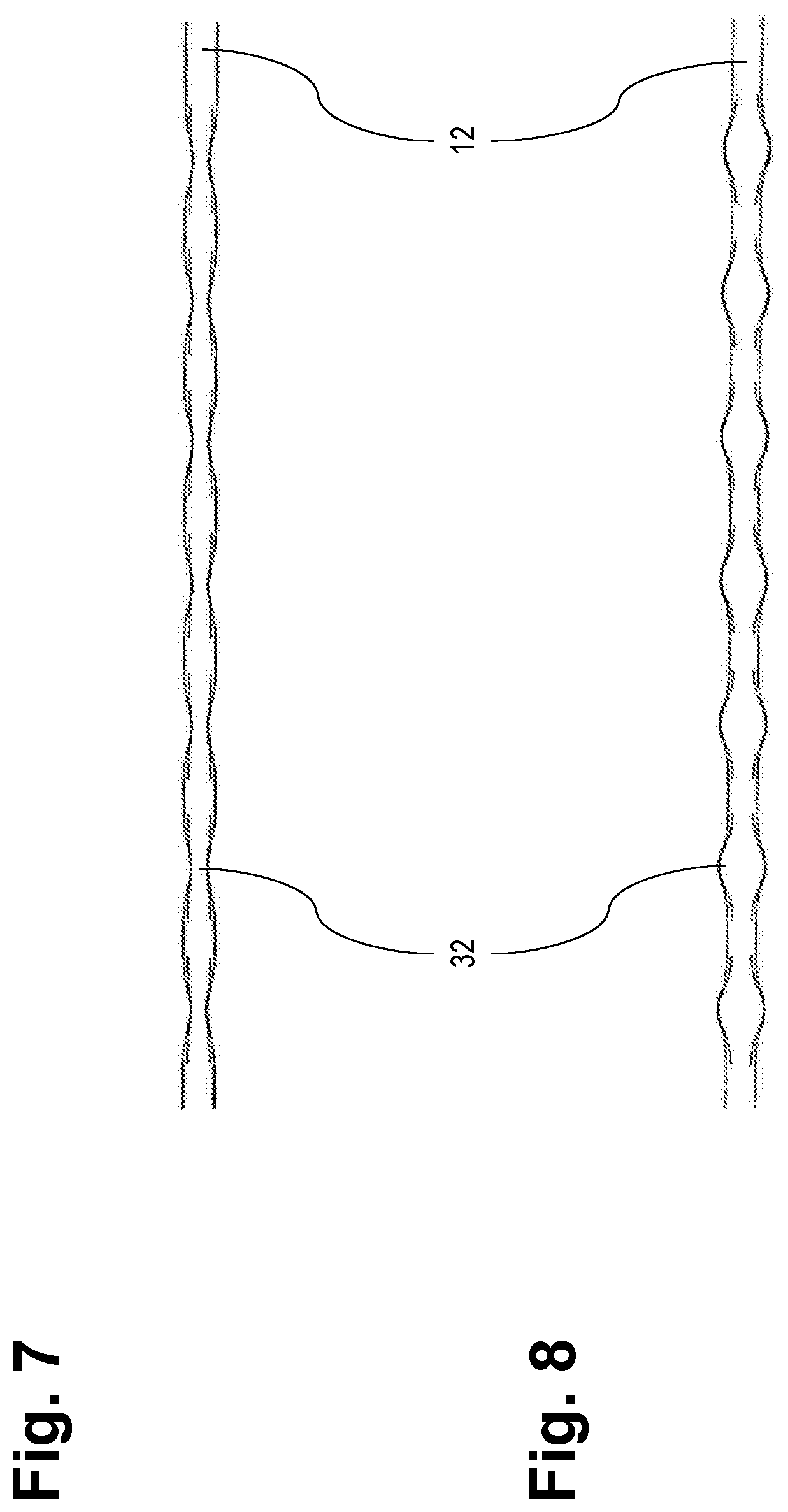 Load distributor for a sternum closure device and tool for cutting the load distributor