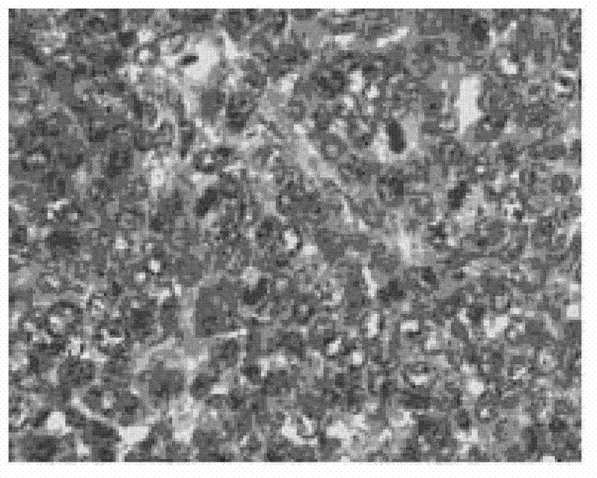 Preparation method and application of tree-like polyester-polyglycidol block polymer