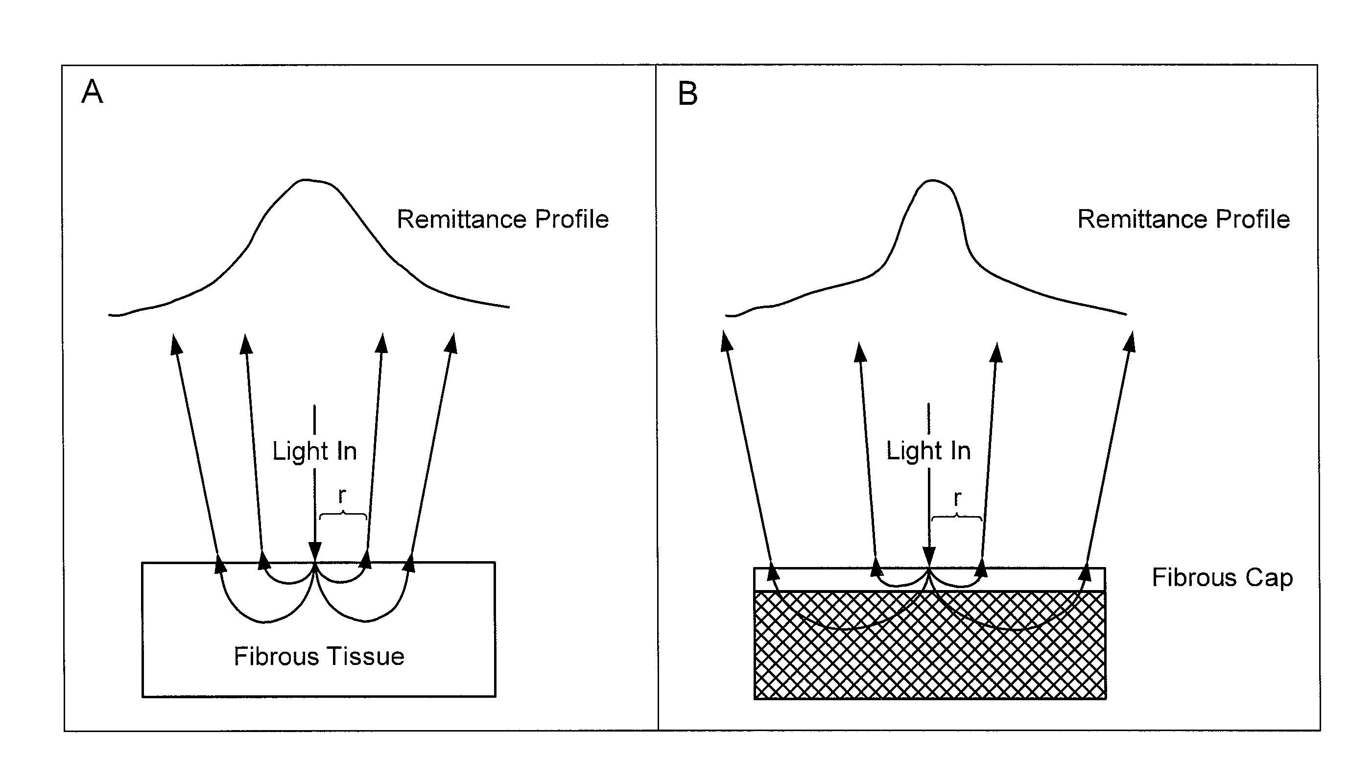 Method and apparatus for determination of atherosclerotic plaque type by measurement of tissue optical properties