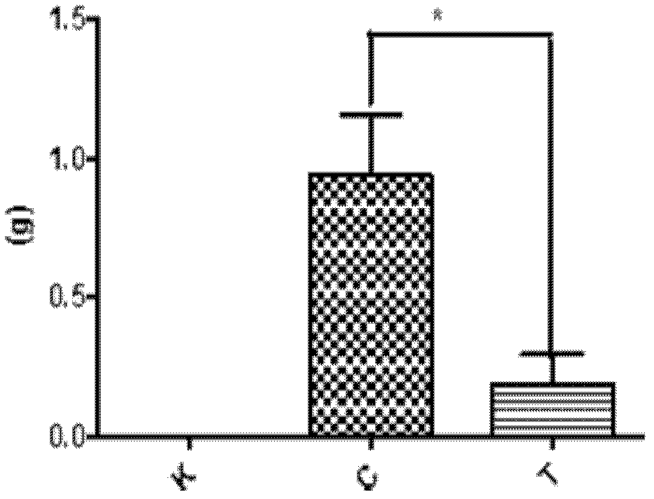 Application of thymosin extrasin alpha in preparing medicine for preventing and curing cancer of liver