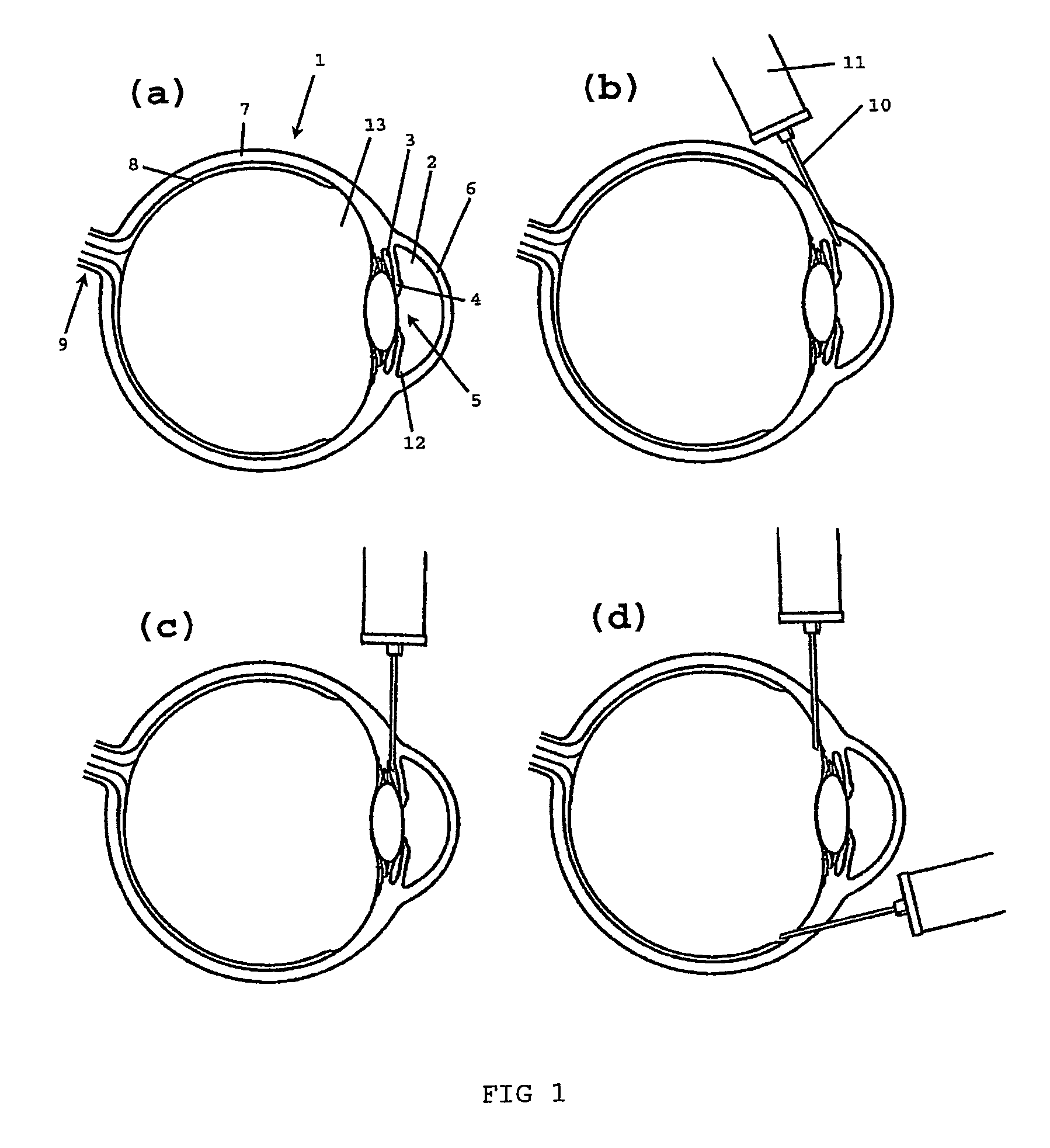 Use of a viscoelastic composition for treating increased intraocular pressure