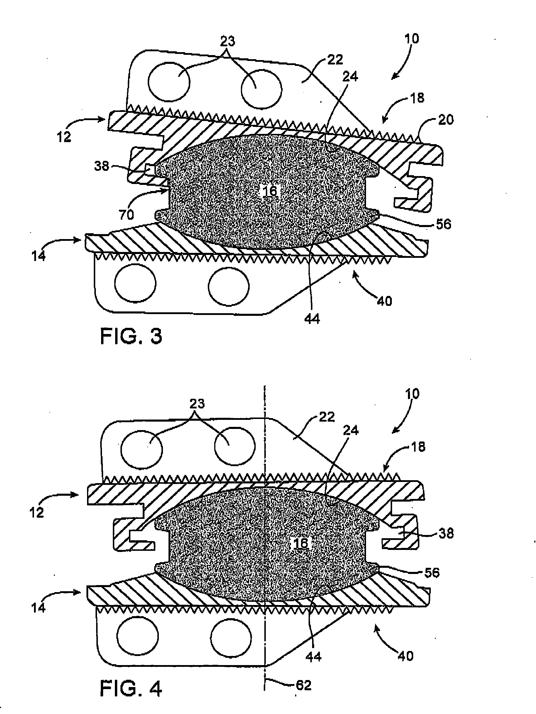 Prosthetic disc for intervertebral insertion