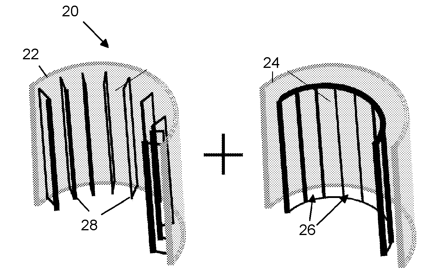 Dual-tuned tem/birdcage hybrid volume coil for human brain and spectroscopy