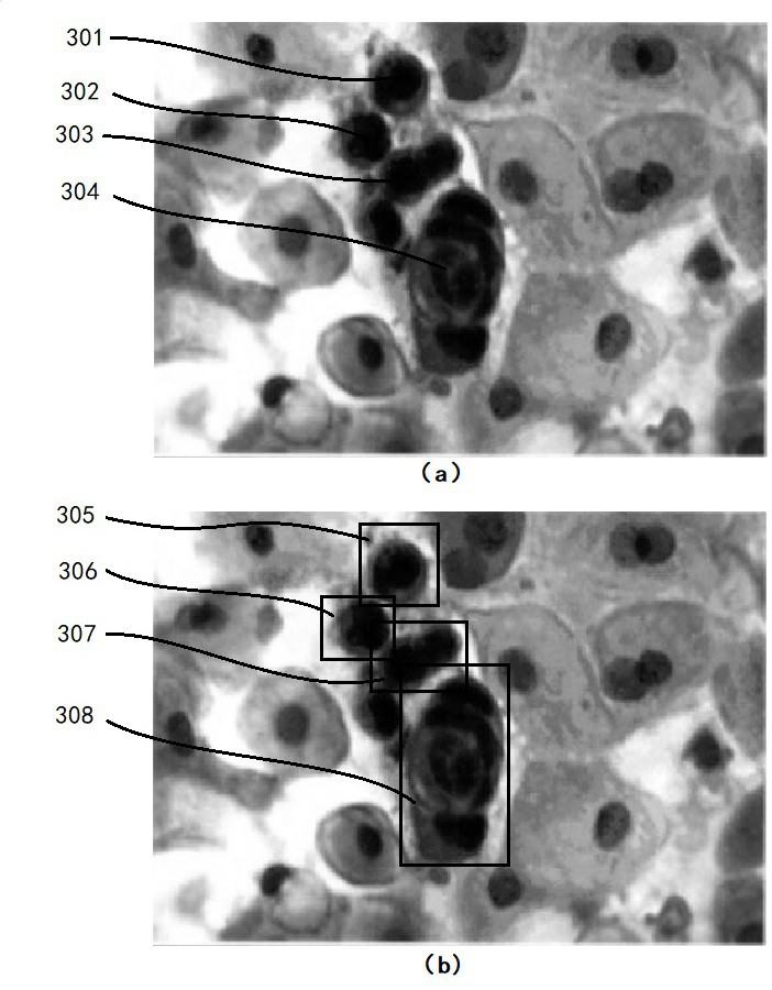 Cervical cancer cytology artificial intelligence screening method and device