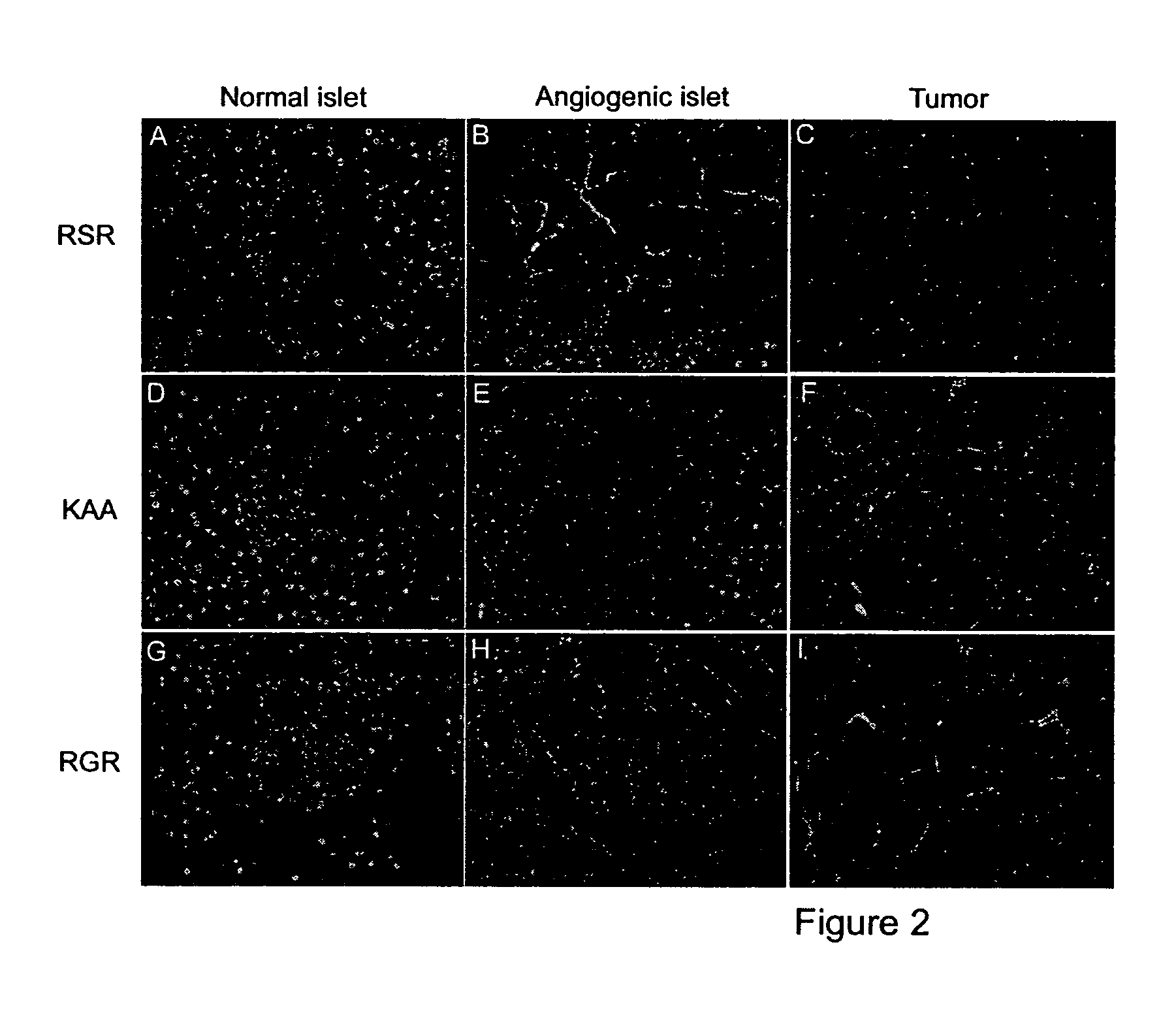 Molecules that selectively home to vasculature of premalignant or malignant lesions of the pancreas and other organs