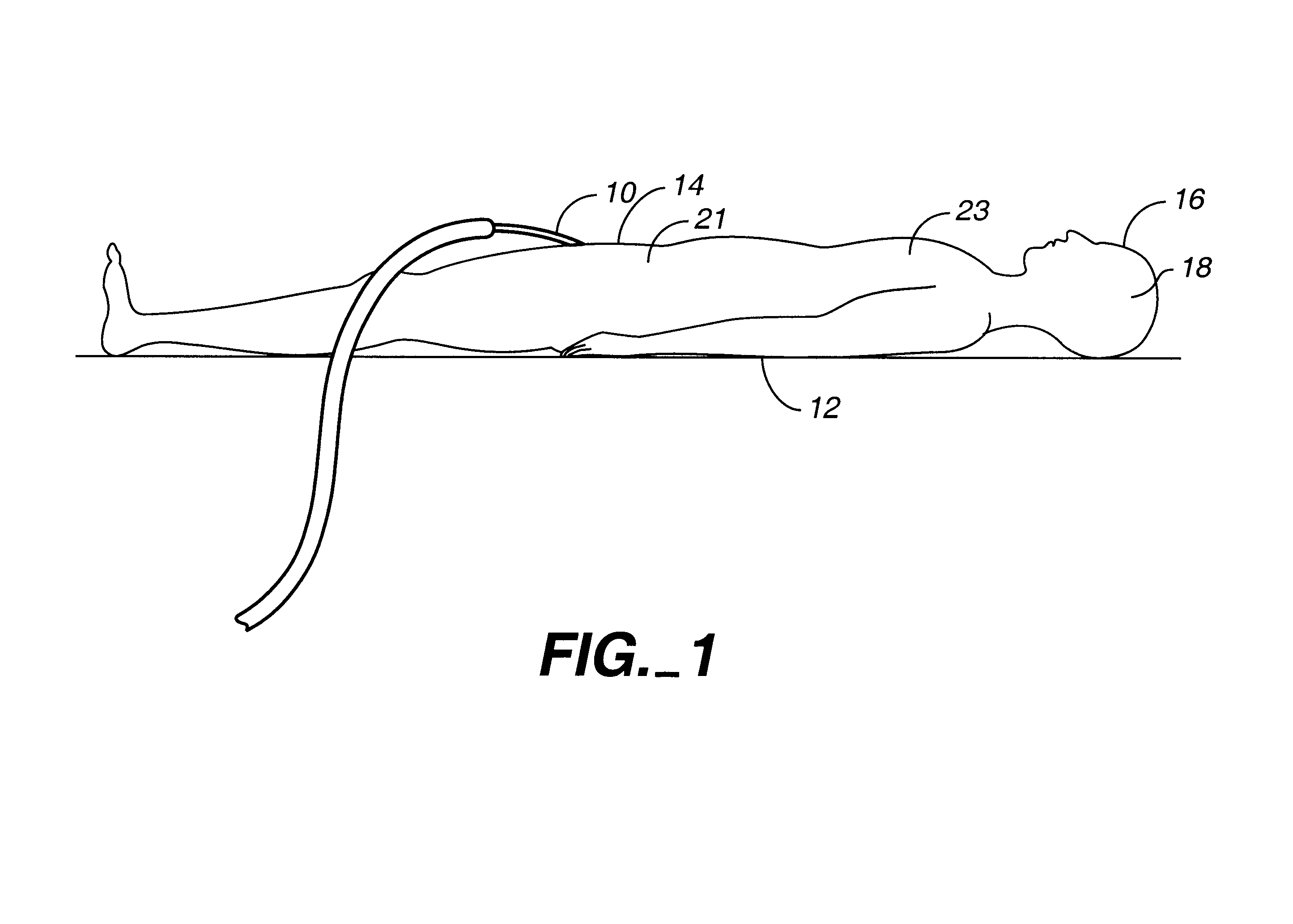 Indwelling heat exchange heat pipe catheter and method of using same