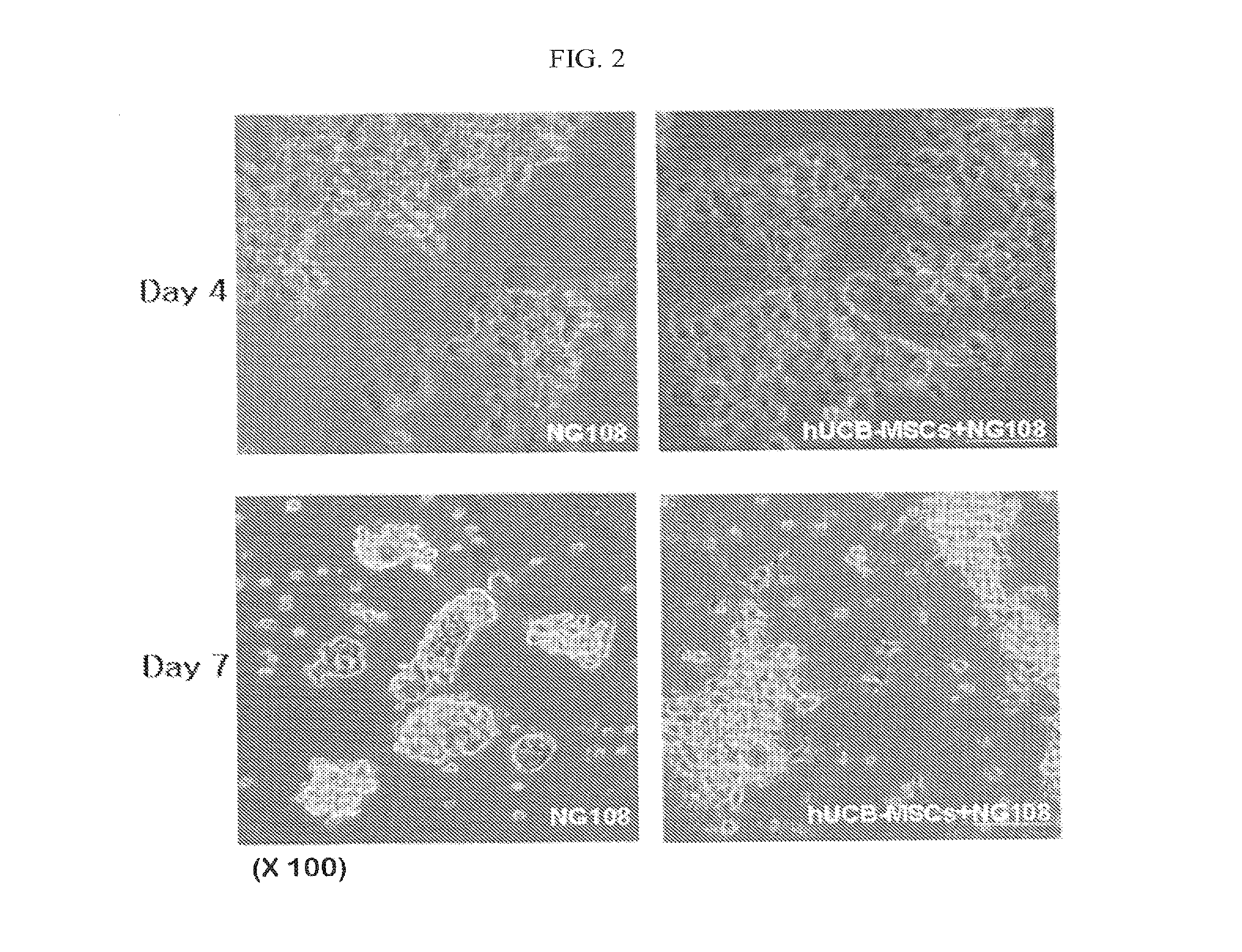 Composition containing human umbilical cord blood-derived mesenchymal stem cell for inducing differentiation and proliferation of neural precursor cells or neural stem cells to neural cells