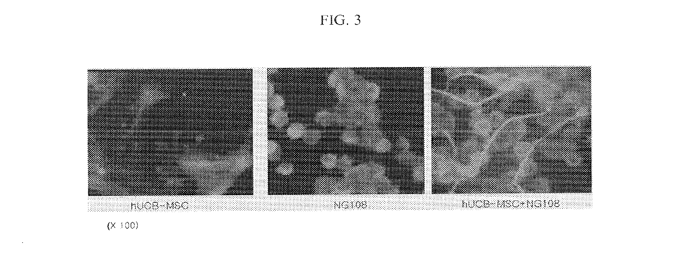 Composition containing human umbilical cord blood-derived mesenchymal stem cell for inducing differentiation and proliferation of neural precursor cells or neural stem cells to neural cells