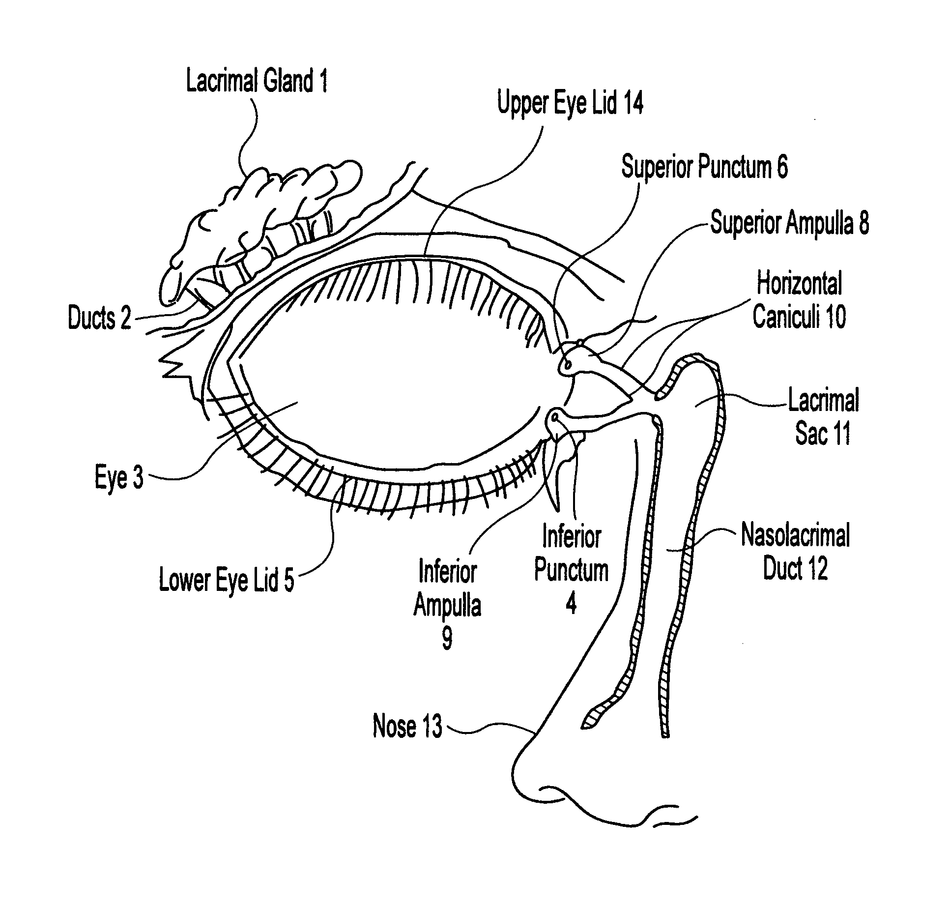 Method for preventing nasolacrimal duct obstruction