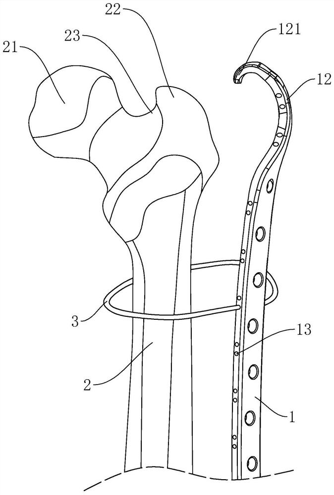 Proximal femur internal fixation plate and machining tool and technology thereof