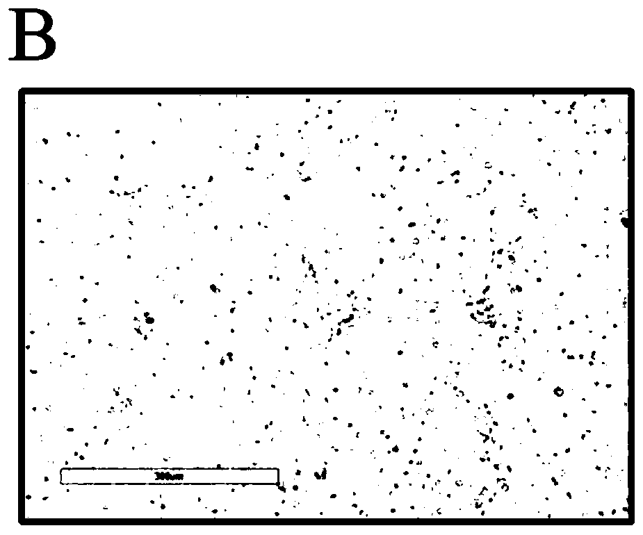 Application of a CD47 antibody in a liver cancer radiotherapy sensitivity detection kit