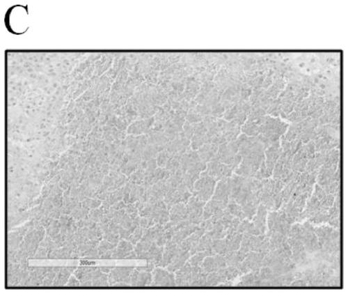 Application of a CD47 antibody in a liver cancer radiotherapy sensitivity detection kit