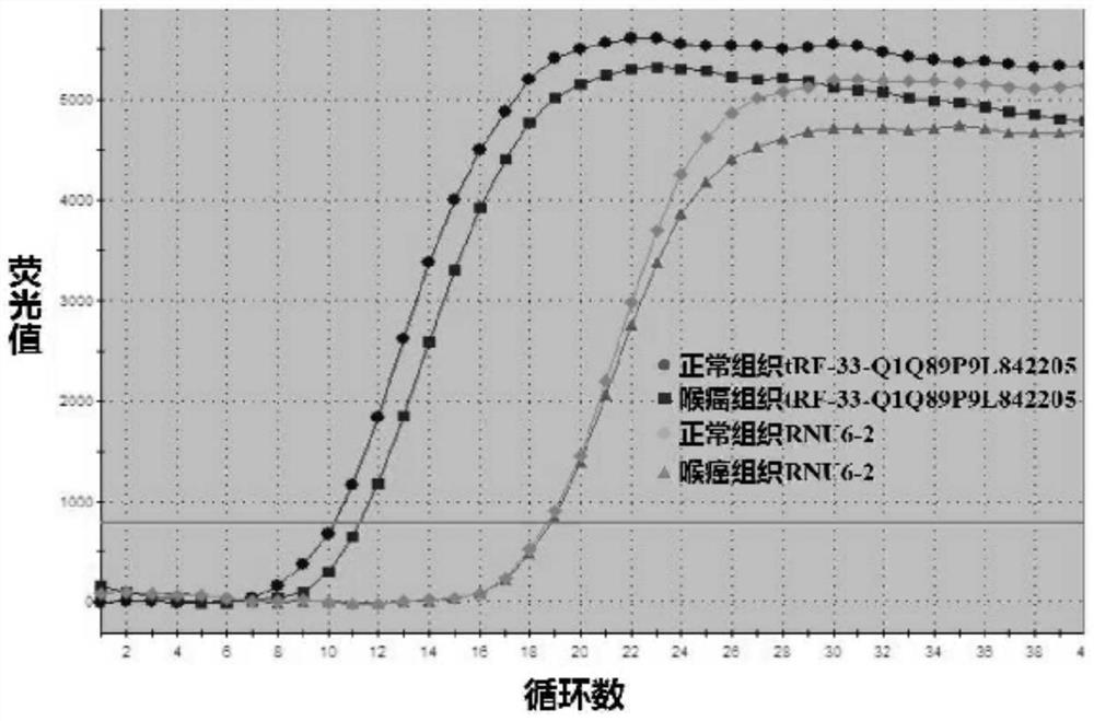 Application of tRF expression primer in detection tissue in preparation of laryngeal cancer auxiliary diagnosis kit