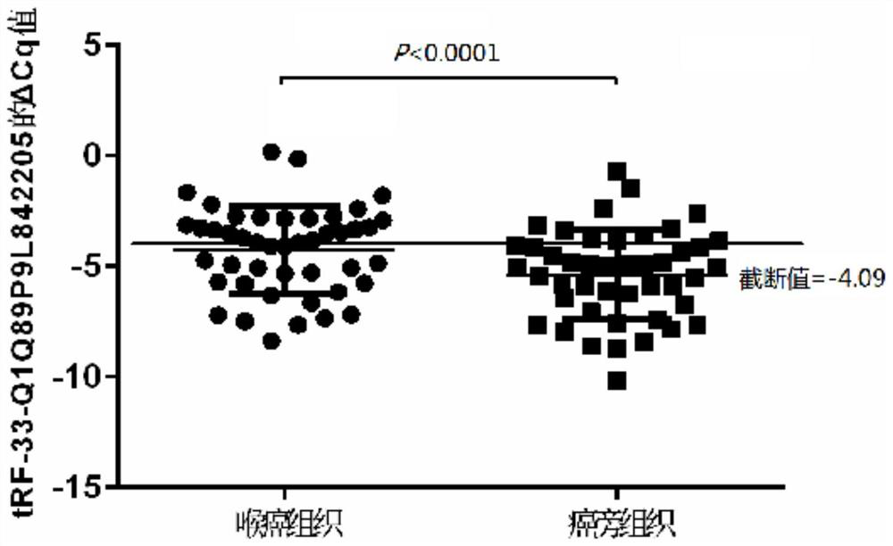 Application of tRF expression primer in detection tissue in preparation of laryngeal cancer auxiliary diagnosis kit