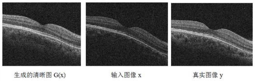 Cataract OCT image restoration method and system based on machine learning