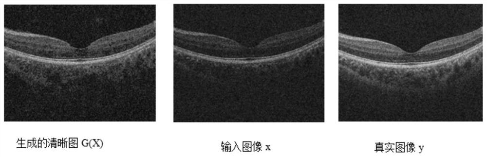 Cataract OCT image restoration method and system based on machine learning