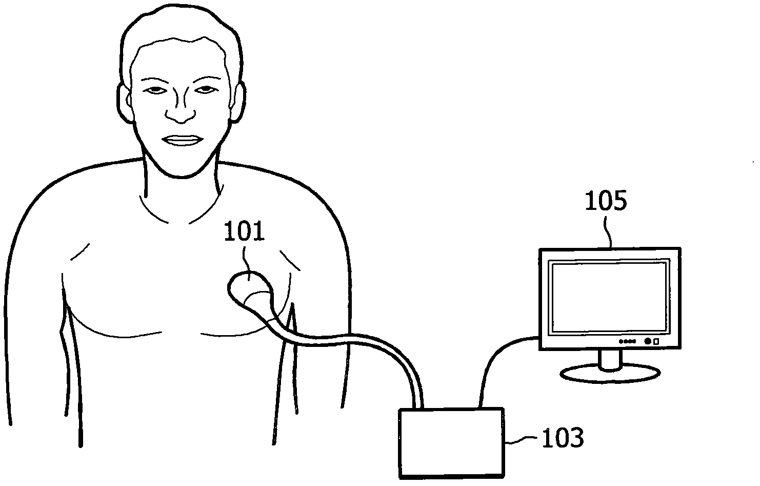 Tissue strain analysis