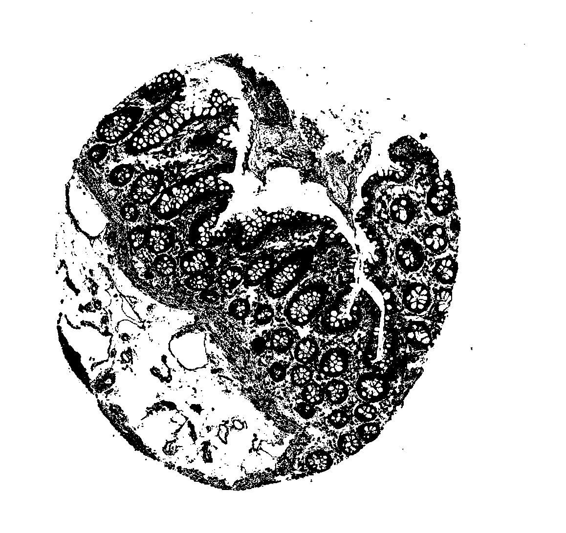 Application of DDX20 in preparation of rectal cancer postoperative prognosis evaluation kit