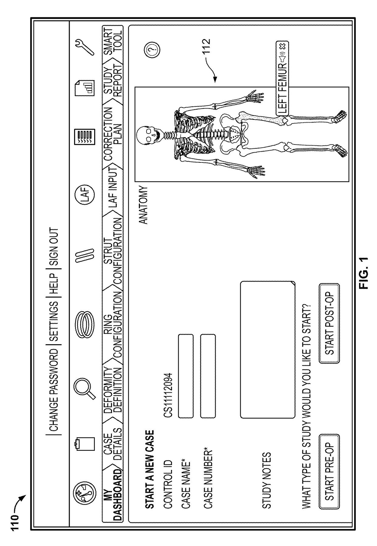 Software for use with deformity correction