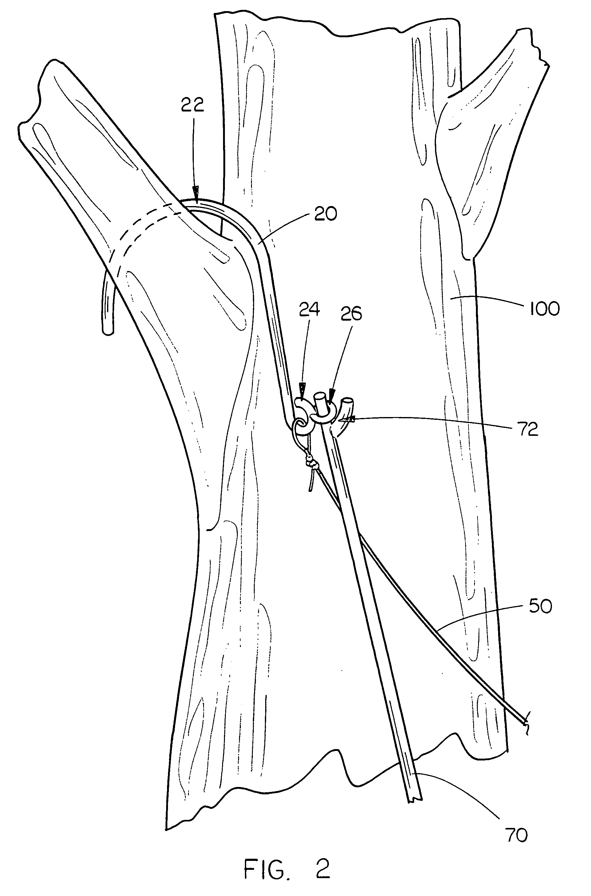 Protective lifting system for outdoor use