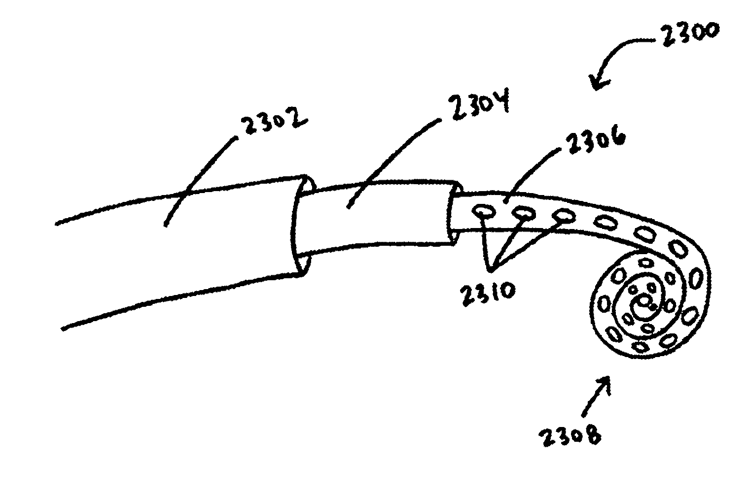 Devices, systems, and methods for promotion of infarct healing and reinforcement of border zone