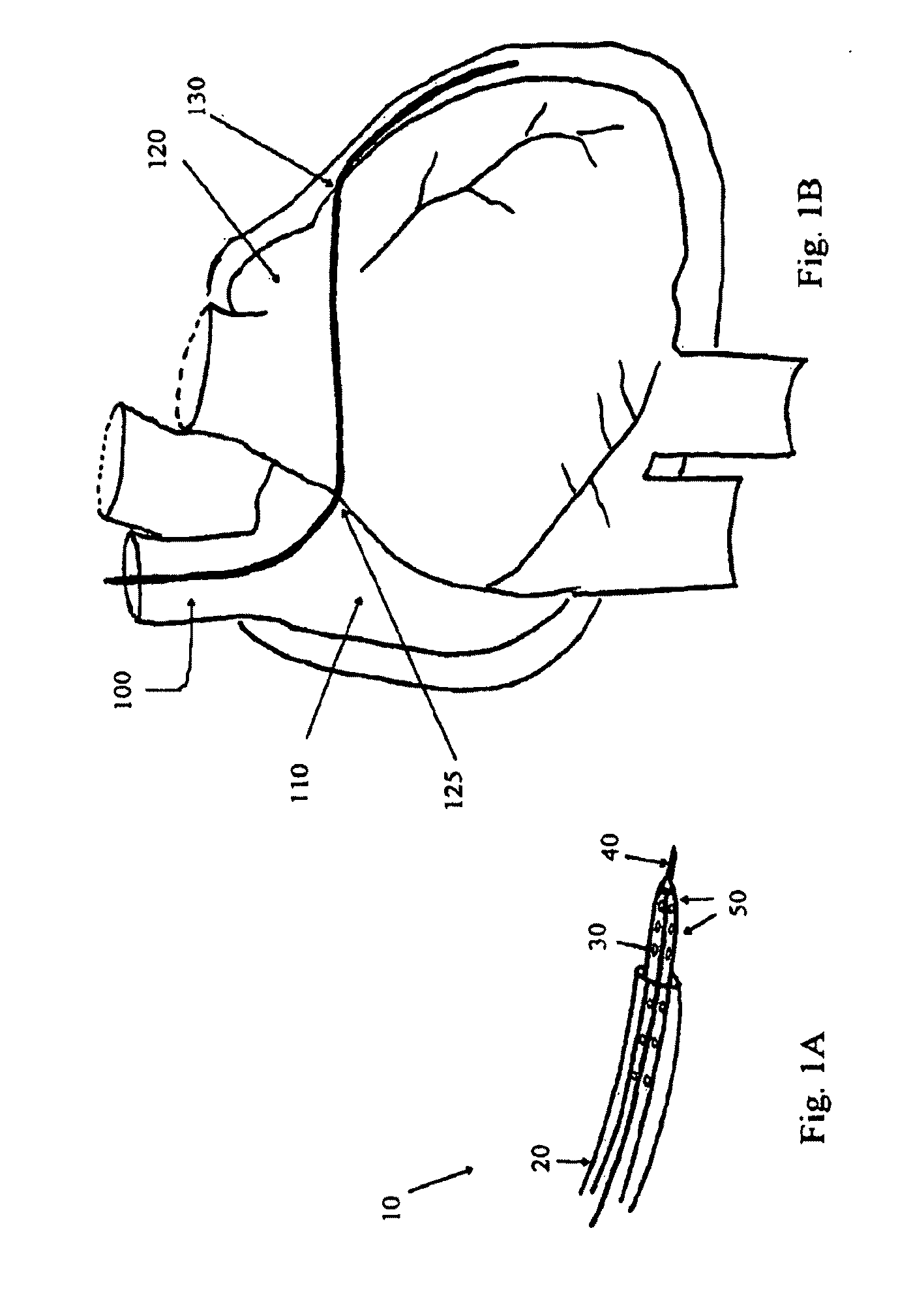 Devices, systems, and methods for promotion of infarct healing and reinforcement of border zone