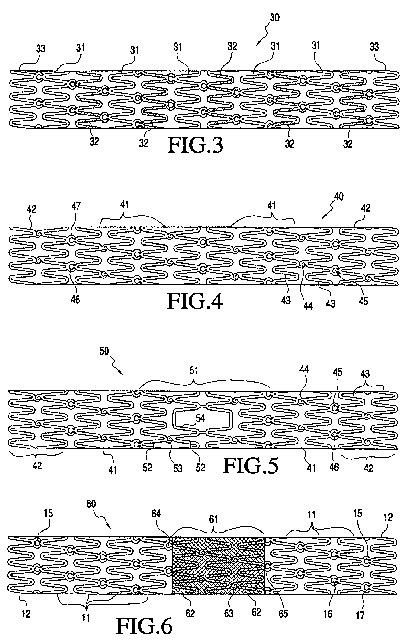 Modular vascular prosthesis and methods of use