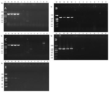 Clostridium welchii specific detection primer and detection kit