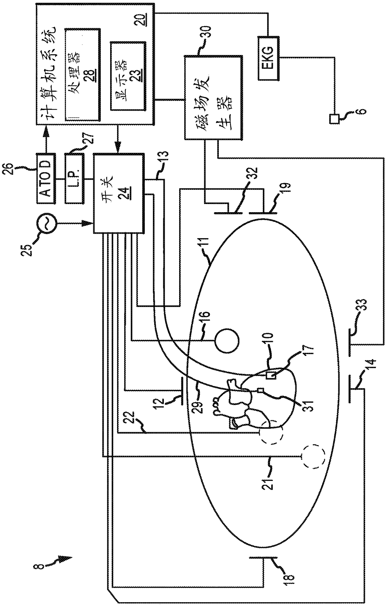 System and method for electrophysiology procedures