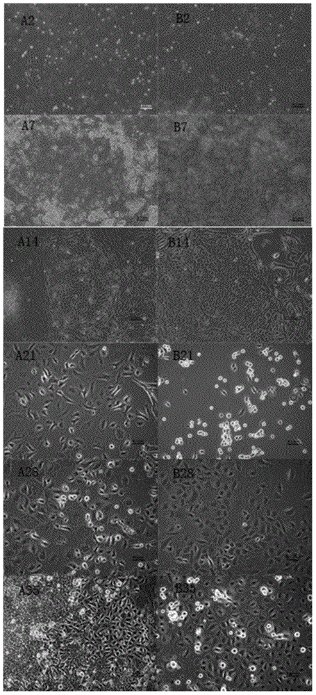 Inducing agent and medium for inducing directional differentiation of embryonic stem cell into keratinocytes