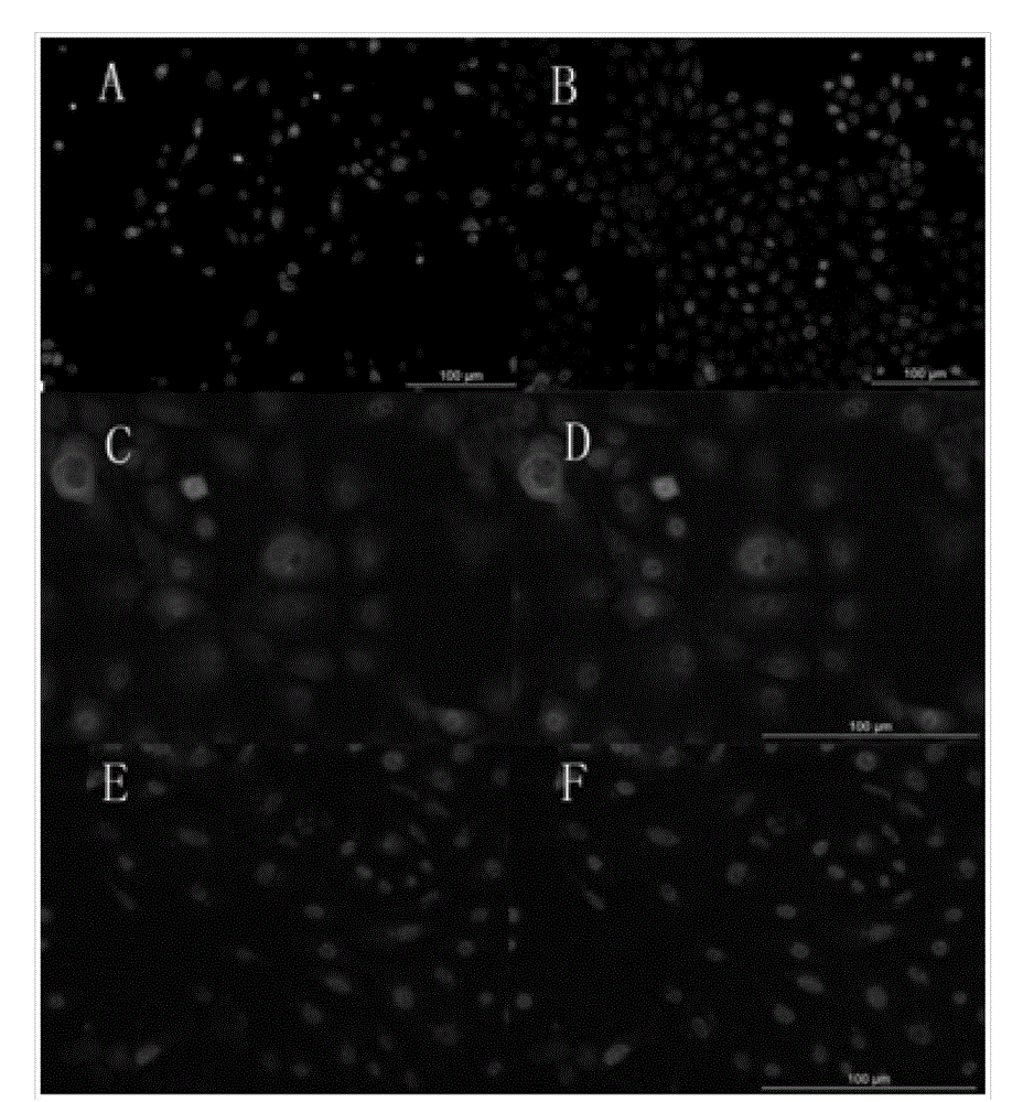 Inducing agent and medium for inducing directional differentiation of embryonic stem cell into keratinocytes