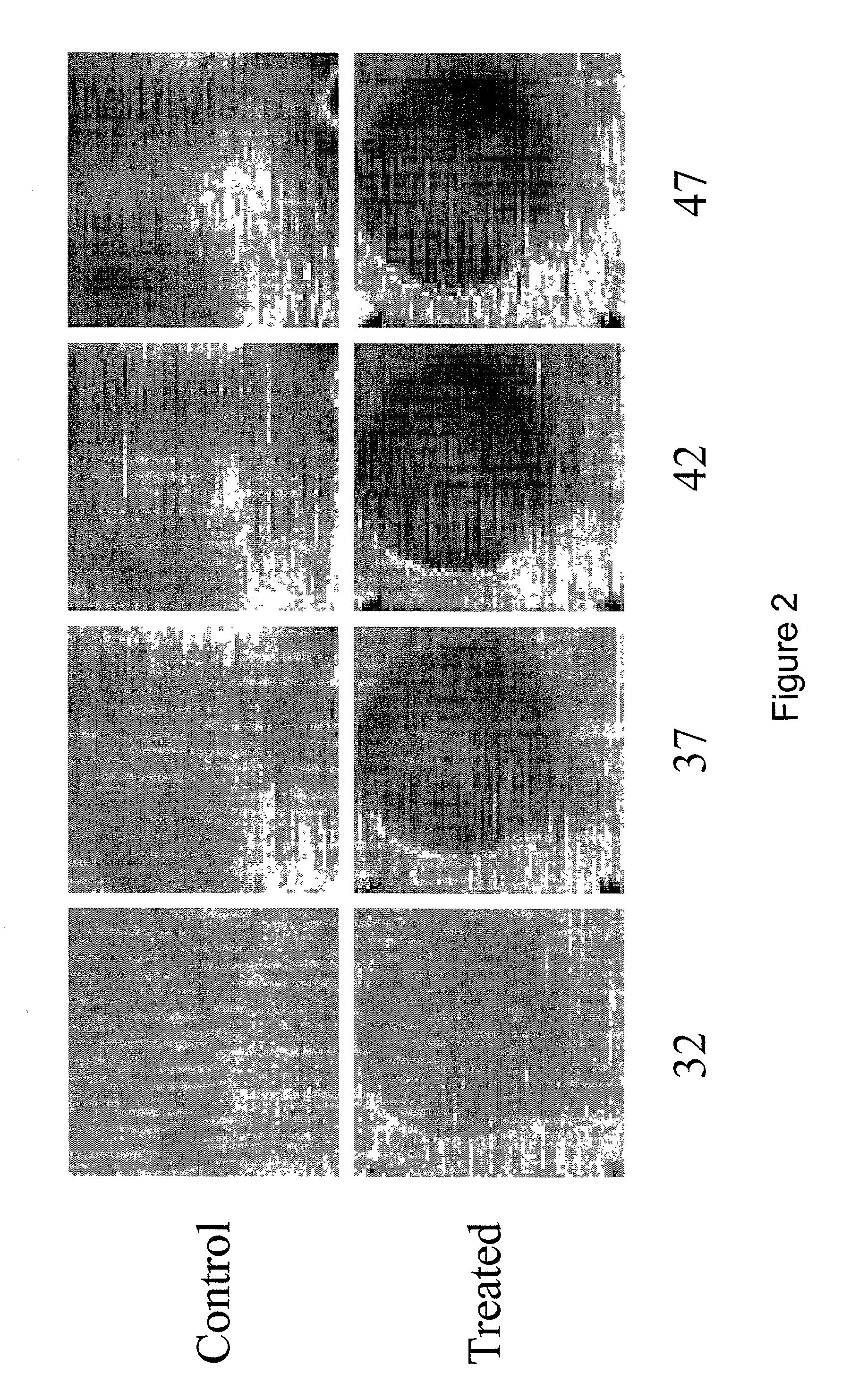 Enhanced ultrasound detection with temperature-dependent contrast agents