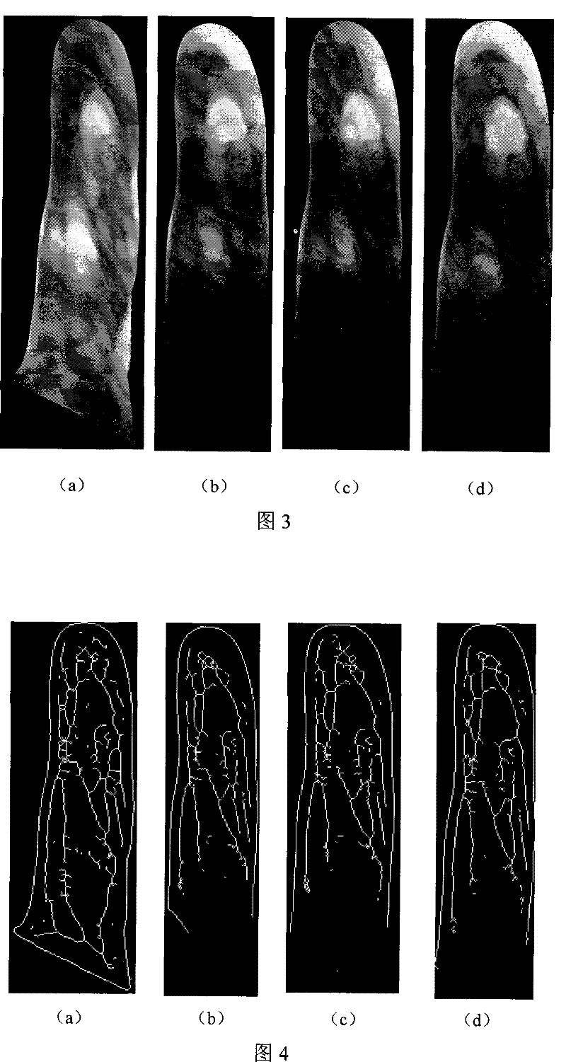 Method and device for collecting blood-vessel image under near infrared light