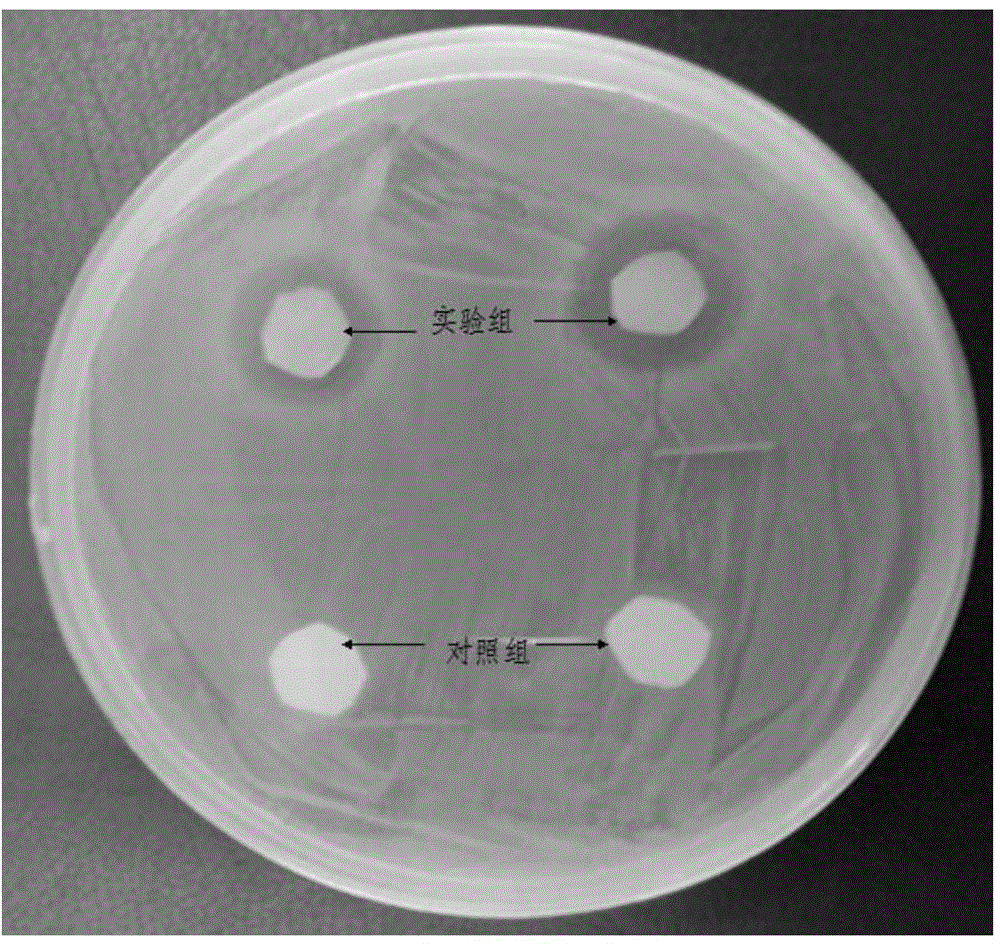 Phenytoin derivative as well as preparation method and application thereof