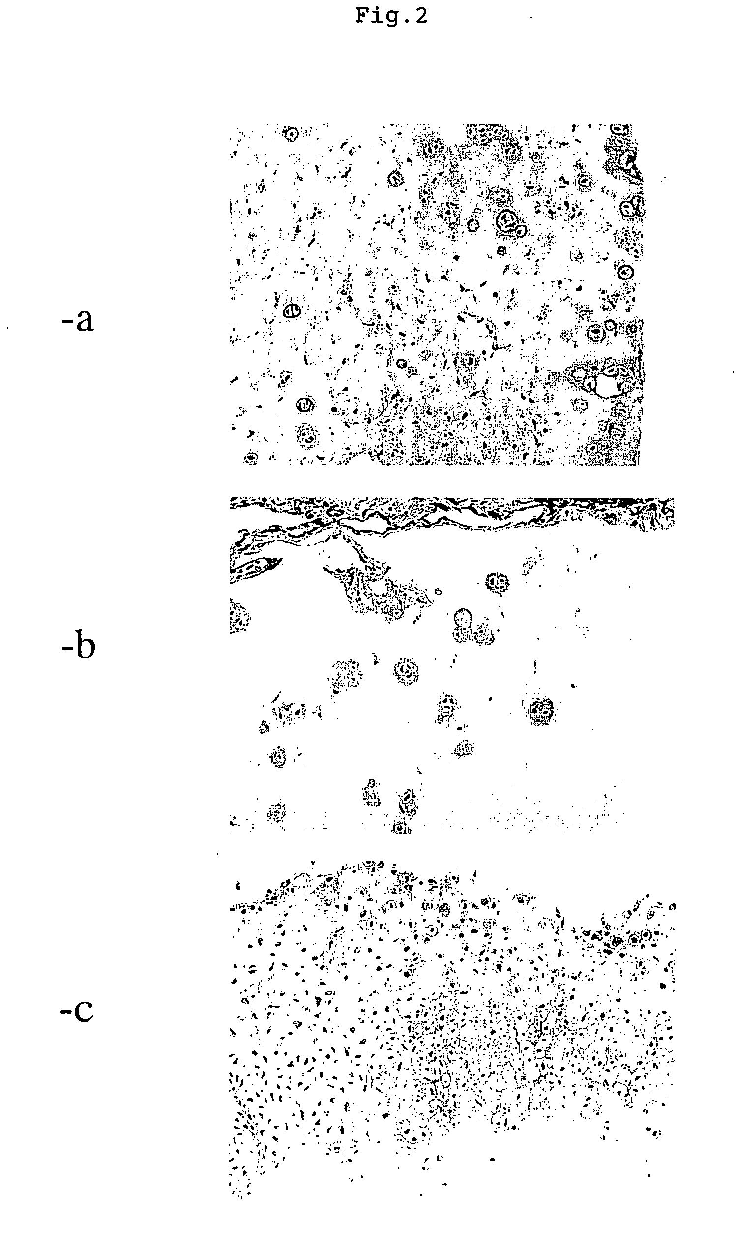 Method of Three-Dimesionally Culturing Chondrocytes