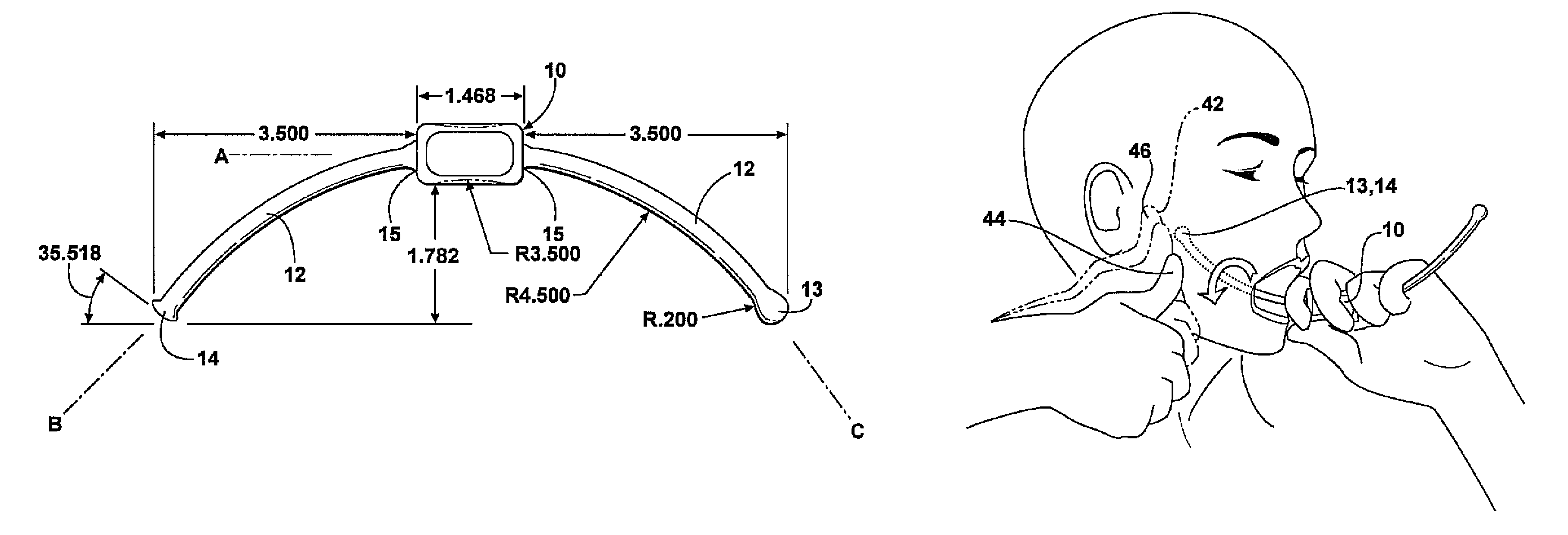 Method and apparatus for intra oral myofascial trigger point therapy