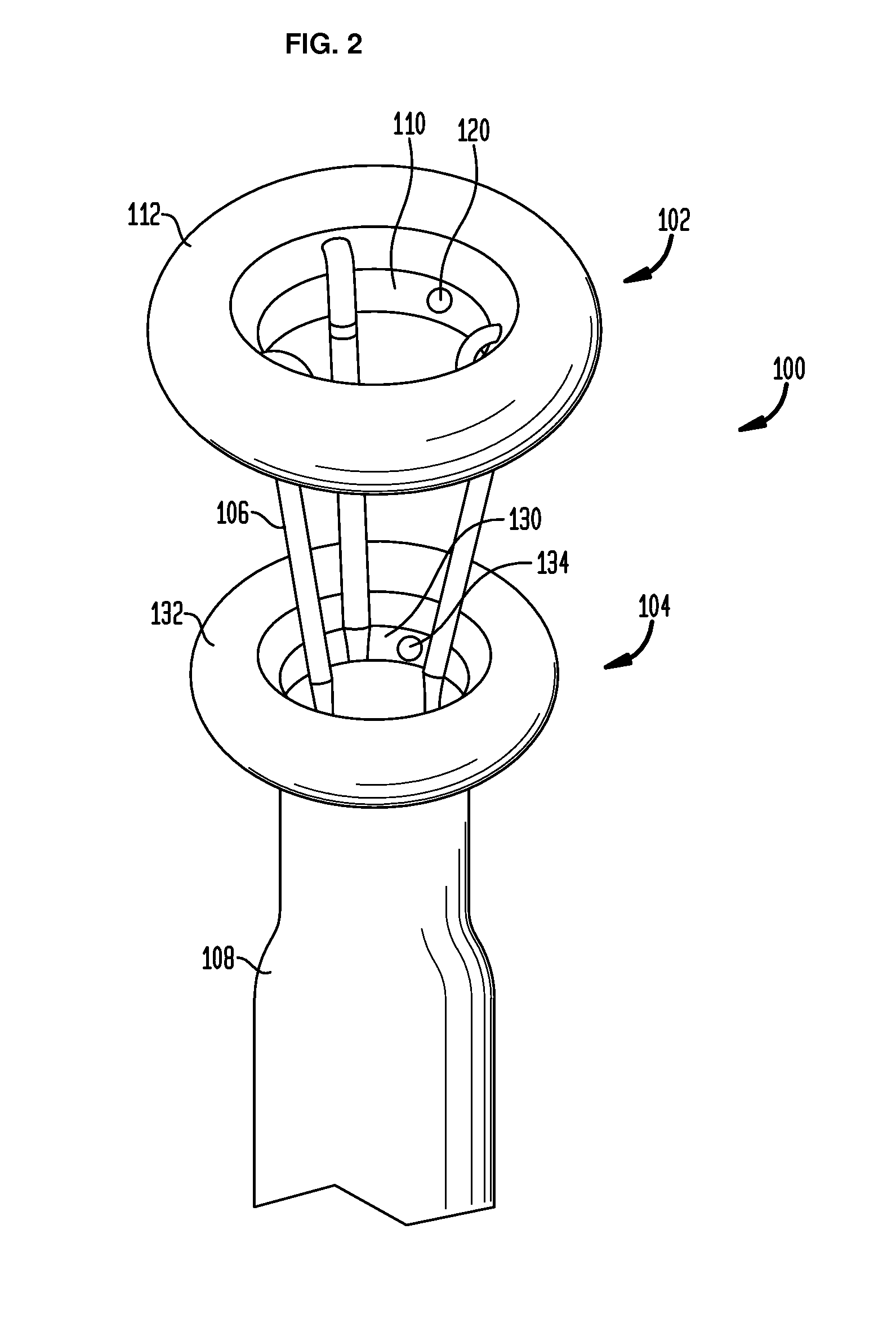 Systems and methods for treatment of obesity and type 2 diabetes